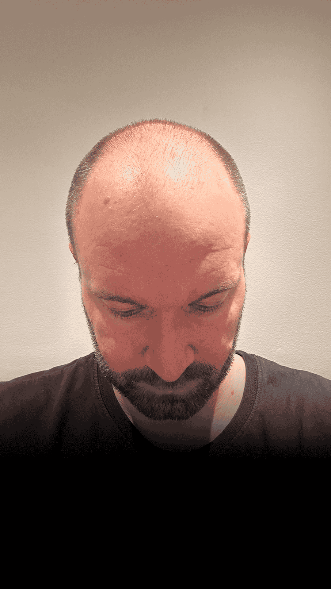 Resultat for Sebastian, 31, Copenhagen - før